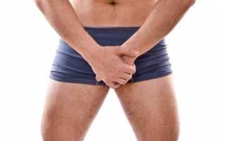 Отек левого семенника — как быть?