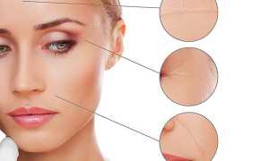 Безинъекционная мезотерапия: альтернатива классическим уколам или пустая трата средств