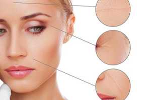 Безинъекционная мезотерапия: альтернатива классическим уколам или пустая трата средств