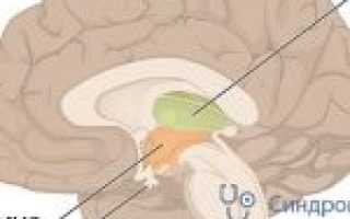 Определение ирритативных изменений на ЭЭГ в Юсуповской больнице
