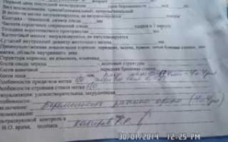 Может ли мне терапевт отказать в направлении на УЗИ?