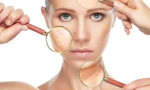 Подтяжка лица без операции — эффективно ли это, выбираем лучший метод