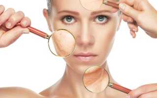 Подтяжка лица без операции — эффективно ли это, выбираем лучший метод