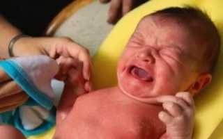 Твердые соски у младенца