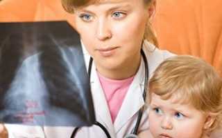 Вирусная пневмония у детей