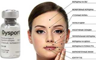 Биоревитализация или диспорт: что лучше, последовательность и совмещение процедур