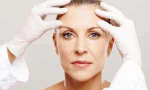 Подтяжка контура лица: особенности процедуры и обзор популярных препаратов
