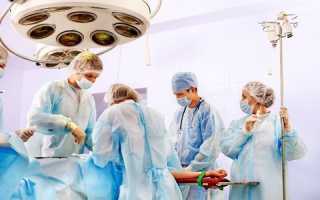 Хирургическое устранение сосудистых узлов в паху