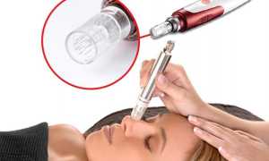 Фракционная мезотерапия: станет ли аппаратное вмешательство полноценной заменой инъекциям