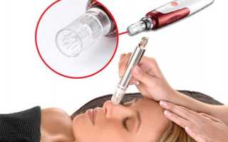 Фракционная мезотерапия: станет ли аппаратное вмешательство полноценной заменой инъекциям