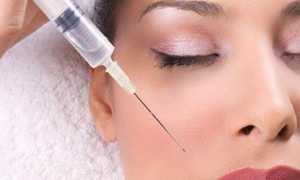 Биоревитализация лица — есть ли риск и какие могут быть негативные последствия