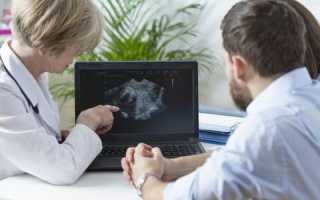 Как улучшить состав семенной жидкости