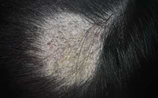 Трихофития