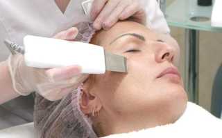 Ультразвуковой пилинг — деликатное очищение и оздоровление кожи