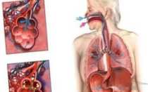 Мог ли кусок еды попасть в лёгкие?