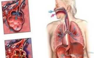 Мог ли кусок еды попасть в лёгкие?