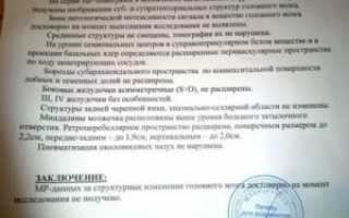 Может ли быть БАС при таком заключении МРТ?