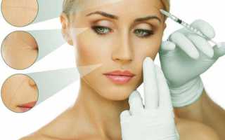 Чем отличается мезотерапия от биоревитализации, что лучше выбрать