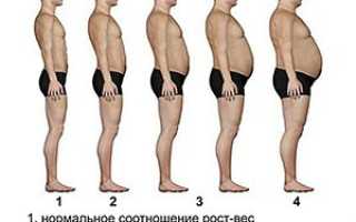 Ожирение 1 степени