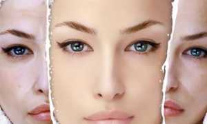 Крем-пилинг Глико А — кому и для каких целей показан, что говорят отзывы об эффективности