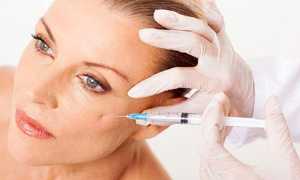 Контурная пластика скул — как стать моложе без последствий