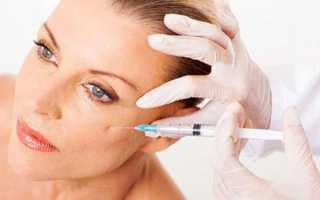 Контурная пластика скул — как стать моложе без последствий