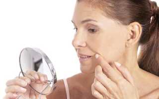 Контурная пластика носогубных складок — все особенности процедуры, плюсы и минусы