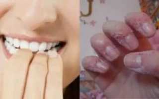 Ребёнок грызёт кожу на пальцах