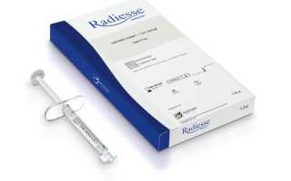 Обзор препаратов Радиесс, что думает об их эффективности Елена Малышева