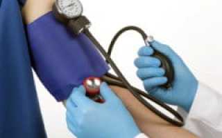 Артериальная гипотензия