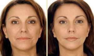 От каких проблем избавит моделирующий массаж лица