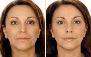 От каких проблем избавит моделирующий массаж лица