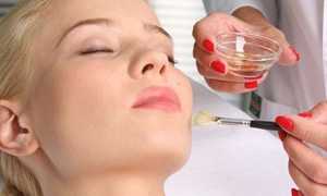 Что лучше сделать для омоложения кожи: химический или лазерный пилинг