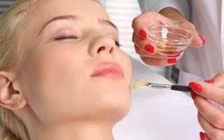 Что лучше сделать для омоложения кожи: химический или лазерный пилинг