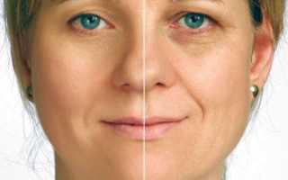 Классический массаж лица — описание техники продления молодости