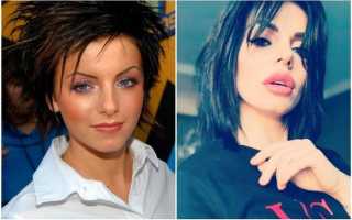 Волкова, Алекса, Погребняк и еще 6 звезд, которые переборщили с увеличением губ