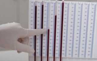 РОЭ в анализе крови