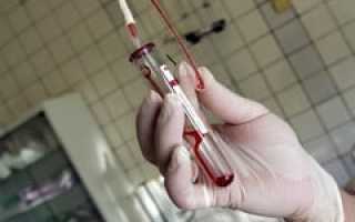 Анализ на краснуху