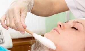 Чистка лица азотом: какая эффективность процедуры при разных проблемах кожи