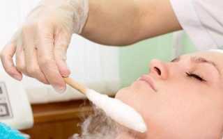 Чистка лица азотом: какая эффективность процедуры при разных проблемах кожи