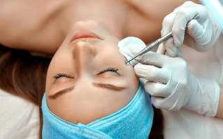 Как выполняется механическая чистка лица, эффективность процедуры в салоне и дома