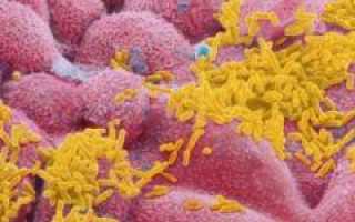 Гемофильная палочка