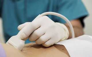 Ультразвуковое исследование почек и зачем назначают подобную процедуру