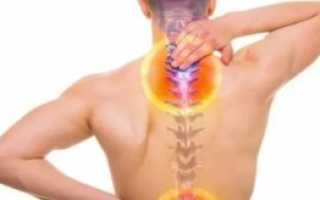Боль в позвоночнике от копчика до шеи