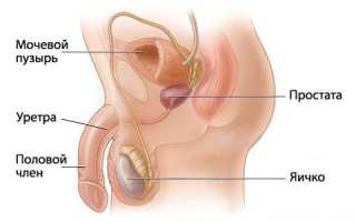 Причины и особенности течения везикуло простатита