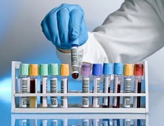 Анализ крови АСТ