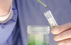 Расшифровка анализа на микоплазму