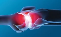 Гиперурикемия