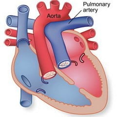 Легочная артерия
