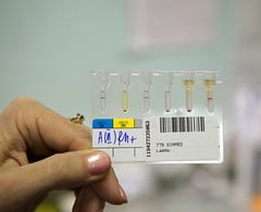 Анализ крови на РОЭ